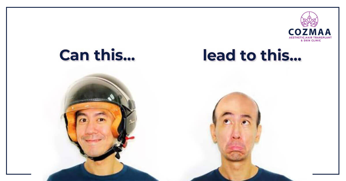 Does wearing a helmet causes hair_loss?