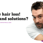 Early age hair loss Reasons and solutions!
