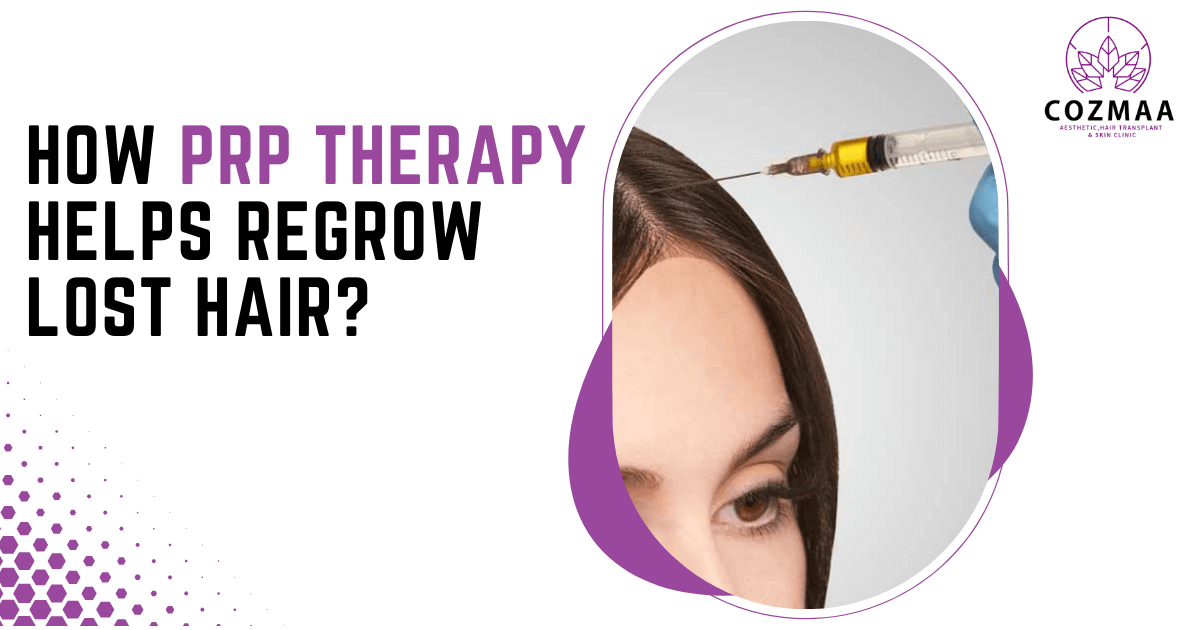 How PRP Therapy Helps Regrow Lost Hair?