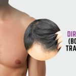 What is Direct-BHT (Body Hair Transplant)?