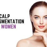Why is scalp micropigmentation for women becoming more and more popular?