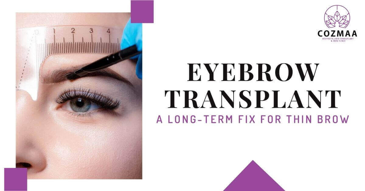 Eyebrow transplant: A Long-Term Fix For Thin Brows