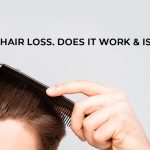 PRP for hair loss. Does it work & is it safe?