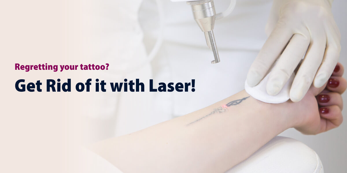 Looking For Tattoo Removal?